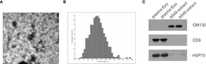 Plasma exosomal tRNA‐derived fragments as diagnostic biomarkers in non-small cell lung cancer